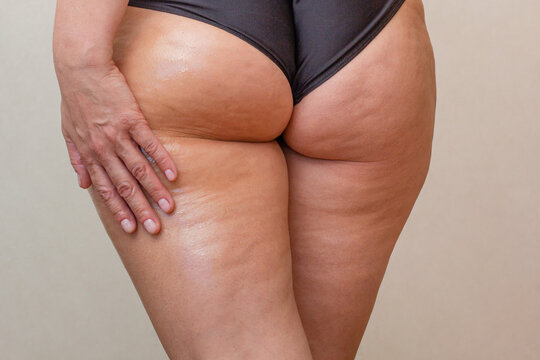 The image depicts a hand massaging anti-cellulite oil into the hip and thigh area