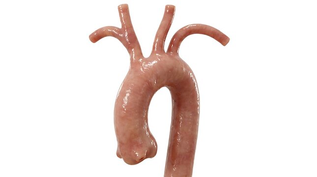 3d render of the human aorta and its major branches, showing the aortic arch and the vessels supplying the head and arms