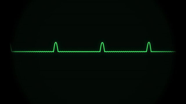 A vintage CRT oscilloscope displays vital sign waveforms and a critical flatline
