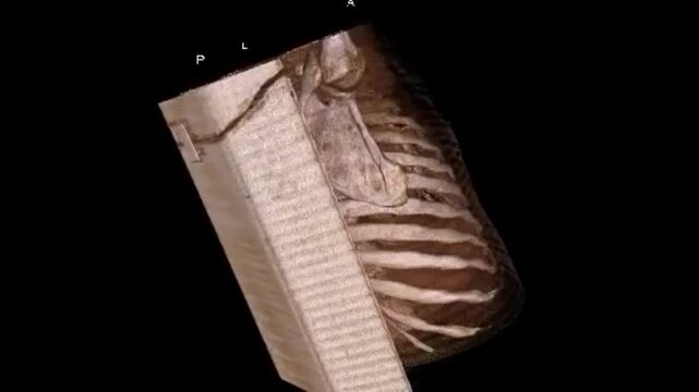 Volumetric 3D Model Render of Chest Cavity and Airway Architecture for Preoperative Bronchoscopy Navigation