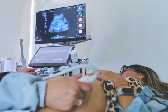 Pregnant woman receiving medical ultrasound scan for prenatal care