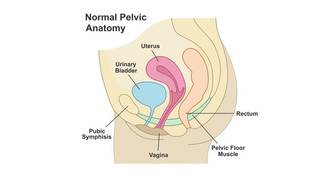 Pelvic floor prolapse of women comparison animation before and after exercise or therapy and treatment. D2 Animation Pelvic floor transformation. 2d render