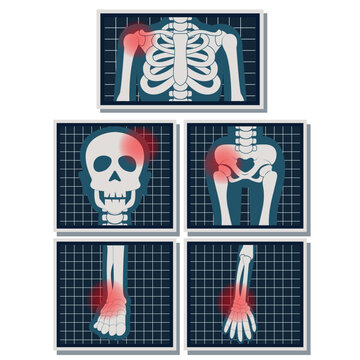 Set of numerous X-ray images of the human body flat design on white background