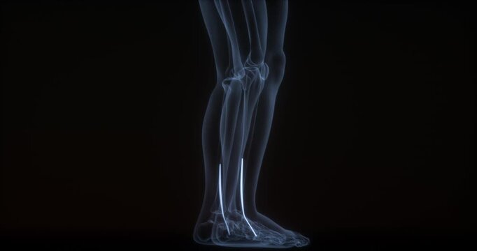 Biceps femoris muscles in human body. X Ray. Loop