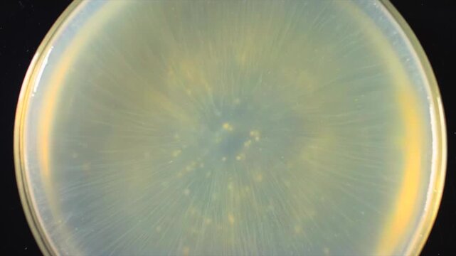 Circular colony expanding top petri view across agar surface, radial microbial growth and pale culture pattern for laboratory testing, contamination control, antibiotic study, microbiology education