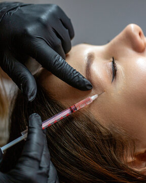 Plastic surgeon injection filler in temple of woman patient, botox. Beautician injects toxin injections in the woman's temple. Beauty and wellness