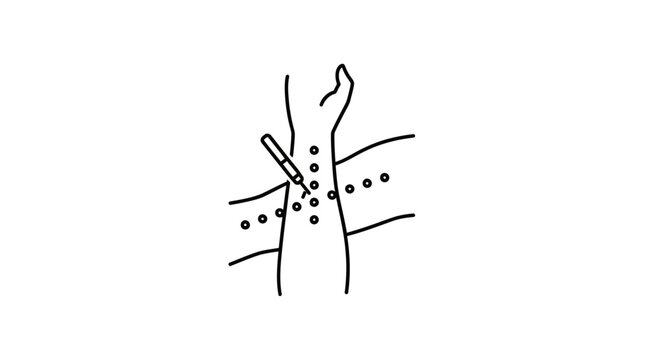 Allergy Test on Arm: Skin Prick Test with Syringe and Punctures