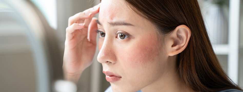 Sensitive skin with cosmetology, Asian young woman looking at red spot on her face from cosmetic allergy in the mirror.