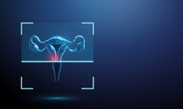 3D blue uterus in scan frame with red spot. Gynecology, cervical cancer, tumor detection, women health, oncology, reproductive medicine, early screening diagnosis concept