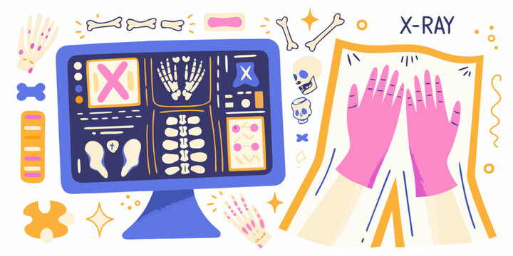 X ray Images And Skeletons Displayed On A Computer Monitor Vector Illustration