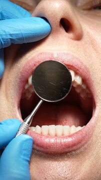 Dental Examination: A Look Inside the Mouth During a Professional Check-Up with Focus on Teeth, Gums, and Dental Tools for Oral Health Assessment