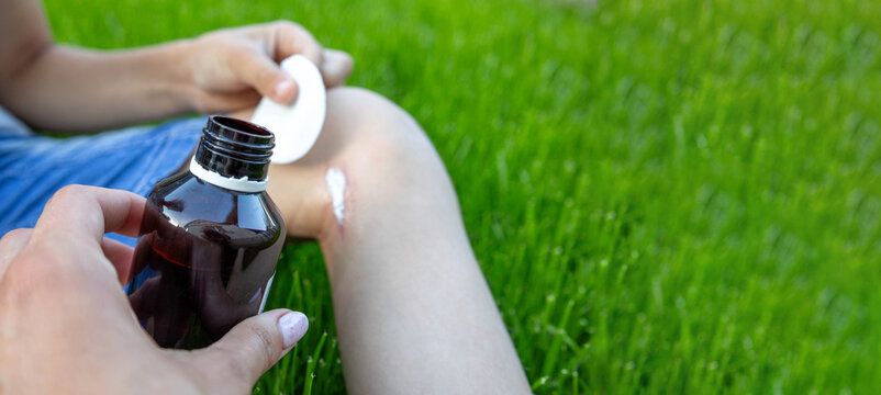 Cleaning a child's injured knee with a cotton pad and hydrogen peroxide