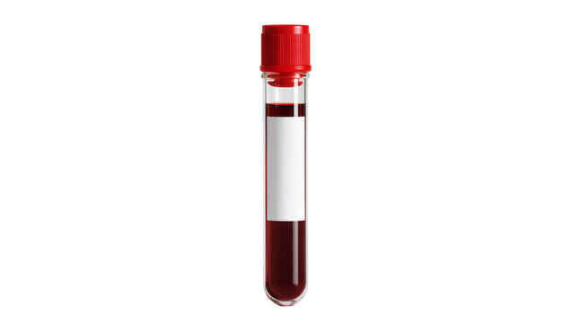 Isolated laboratory tube filled with human blood, ready for medical examination.