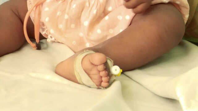 Close Up of Child Foot With IV Cannula During Hospital Treatment for Measles in Bangladesh