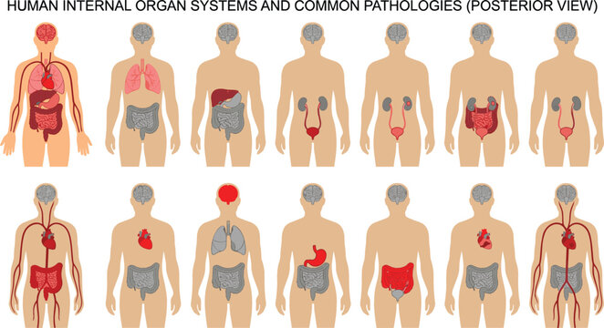 Human Internal Organ Systems and Common Pathologies Vector Set with Anatomy Medical Infographic Icons showing Posterior Body Views