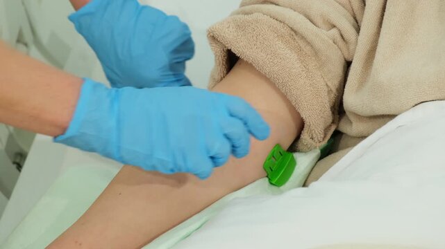 Attentive doctor secures and tightens tourniquet around arm of patient. Physician prepares for safe catheter insertion procedure. Slow motion