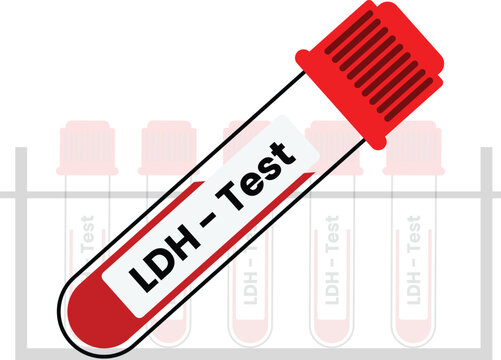 LDH Test Medical Illustration