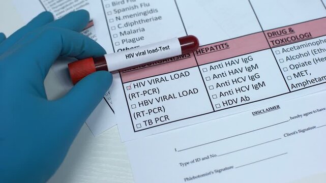 Close-up of a laboratory professional holding a blood sample tube labeled HIV ( Human Immunodeficiency Virus). Concept of inflammation testing, diagnostic pathology, and laboratory medicine.