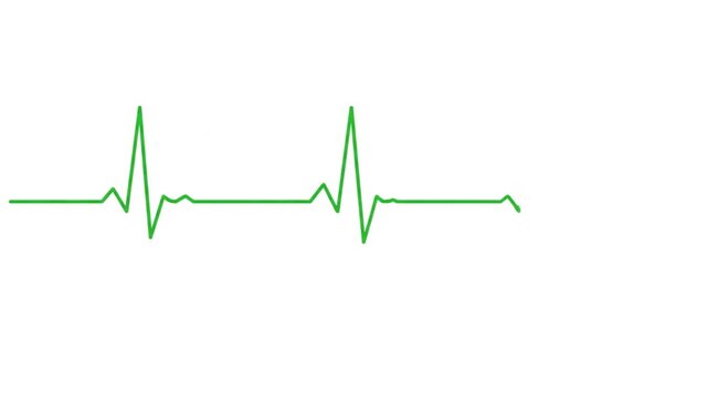 Green electrocardiogram line on white background representing heart rhythm.