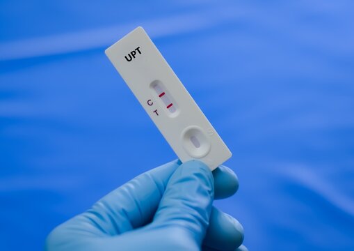Urine sample of patient posiitve result for pregnancy.