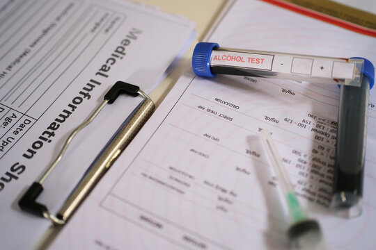 Blood sample test for blood alcohol content above laboratory documents