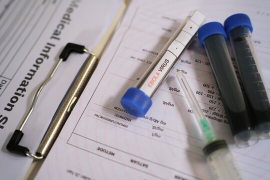 Test tube containing blood sample, blood sample for ebola virus test. Diagnosing, analyzing test results, disease outbreak prevention. Virus outbreak. 
