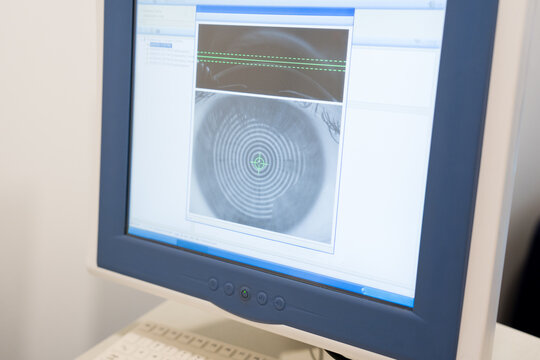 Computer Screen Showing Detailed Eye Scan 