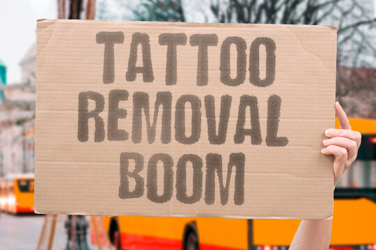 "Tattoo removal boom" Industry for erasing ink is expanding. GROWTH. DEMAND. TECH. CLINICS. SERVICE.