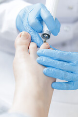 Fototapeta premium Podiatrist treating caucasian adult foot with precision tools
