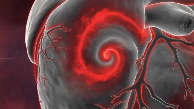 Left Atrial Appendage Slow Flow Swirls in Layered Cardiac Imaging for Health Education