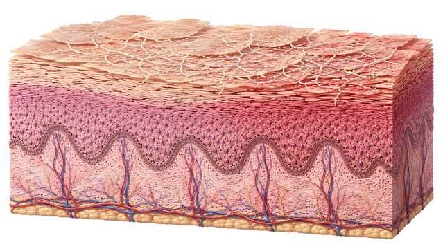 Dermatophyte Fungal Infection Invading Stratum Corneum Human Skin Cross Section Medical Anatomy Illustration
