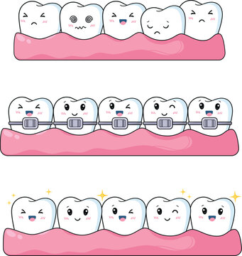 Funny Tooth Character Set with Braces for Orthodontic Clinic
