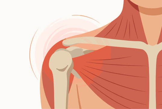 Anatomical illustration showing the muscles and bones of the human shoulder and chest area for medical education.