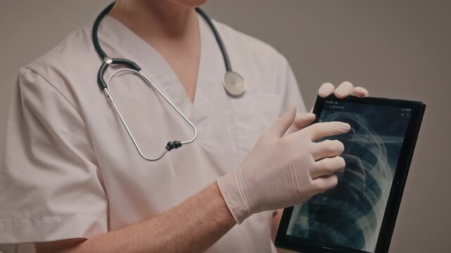 White pulmonologist pointing chest xray tablet, gloved hands explain findings, clinical instruction tone, clear neutral lighting