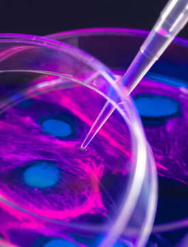 Pipetting of sample into Petri dish containing cell micrograph