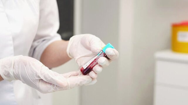 Healthcare professional wearing protective gloves holding a blood sample collection tube in a clinical environment.