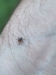 Obraz premium Tick crawling on human skin with body hair, close-up macro of parasite and Lyme disease health risk concept