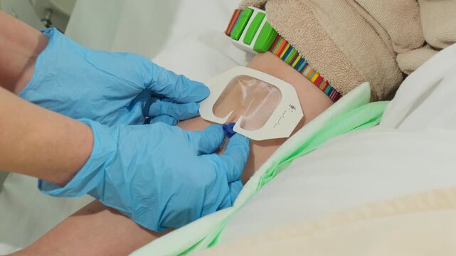 Blue gloved hands fix iv catheter dressing on woman arm near bed. Medical worker presses adhesive patch stabilizing line after insertion