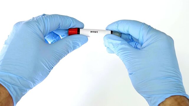 Blood test concept medical research close up shot with hands in blue gloves holding tube with real blood in 4K Ultra HD footage.
