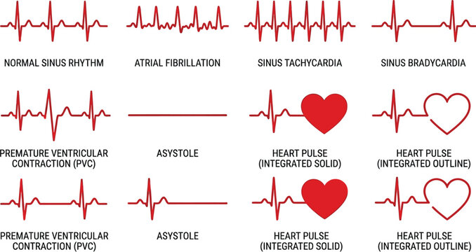 Electrocardiogram readings display various heart rhythm types including sinus tachycardia and ventricular contractions.