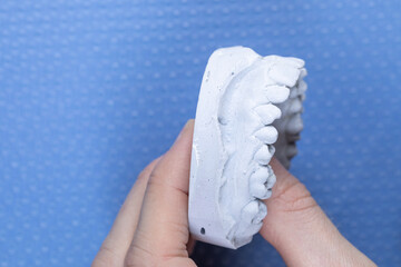 Dental Plaster Cast of Upper Jaw Held in Hand on Blue Background © SWMedia