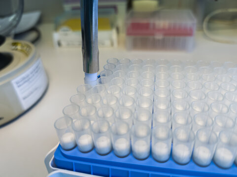 Brussels, Belgium. Automated laboratory pipette dispensing samples into microtubes during DNA extraction workflow.