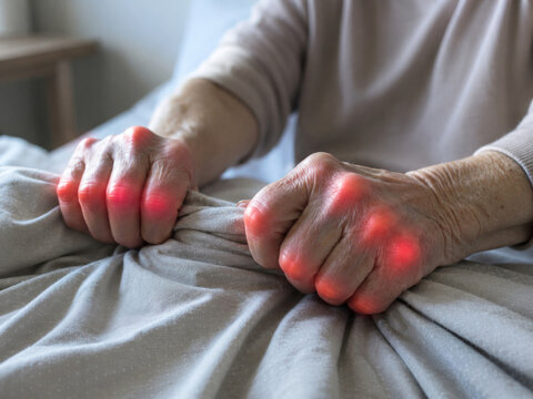 Severe Hand Arthritis Pain Disturbing Sleep in Older Adult