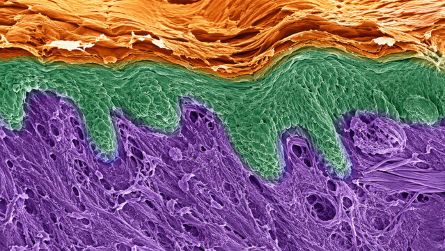 Colorized electron micrograph showing skin dermis cross section with stratified layers in orange, green, and violet, revealing collagen fiber matrix beneath epithelial surface