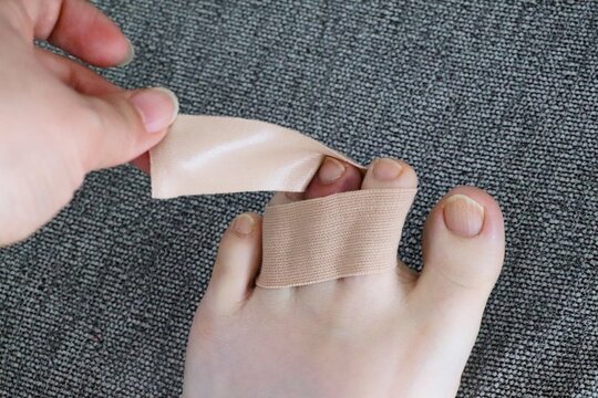 打撲した足指をテーピングで固定する応急処置。セルフケアや怪我の回復、医療をイメージした写真素材。