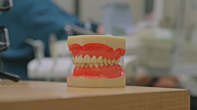 Anatomical teeth and gums educational model displayed in medical dentistry office