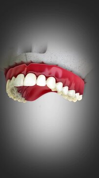 3D animation of removable full denture for the upper jaw.