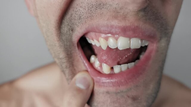 Close-up captures a man pulling back his lip to touch sharp canine teeth with his tongue. The dental detail shows gums and stubble on the chin in a studio setting.