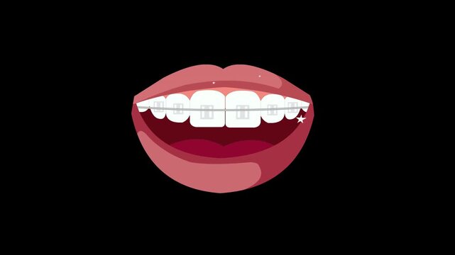 Animation of Smiling Mouth With Braces Showing Teeth and Orthodontic Treatment with alpha