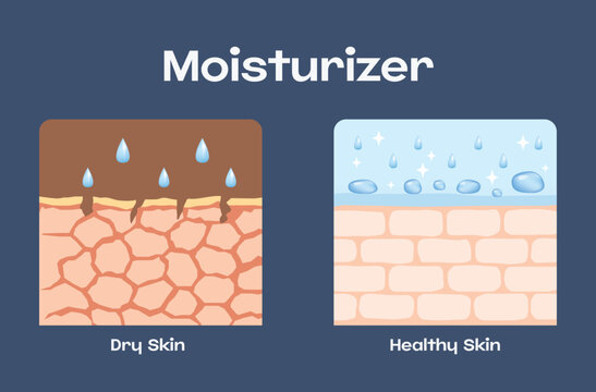 Moisturizer, dry skin and healthy skin, vector design.